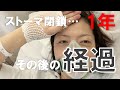 【ストーマ閉鎖後】排便障害とお腹のケアについて　#排便障害　#人工肛門閉鎖術　#卵巣がん