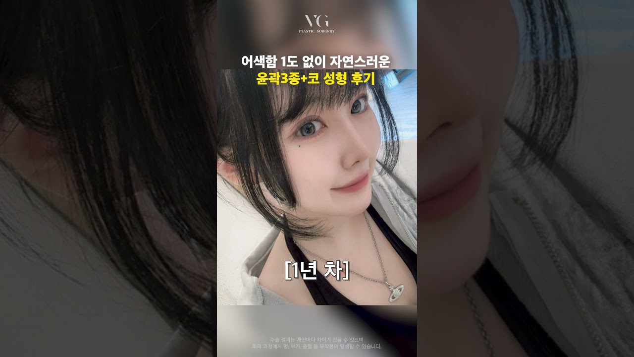 [貝利古整形外科診所] 自然變美的方法