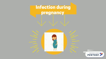 Intellectual Disabilities