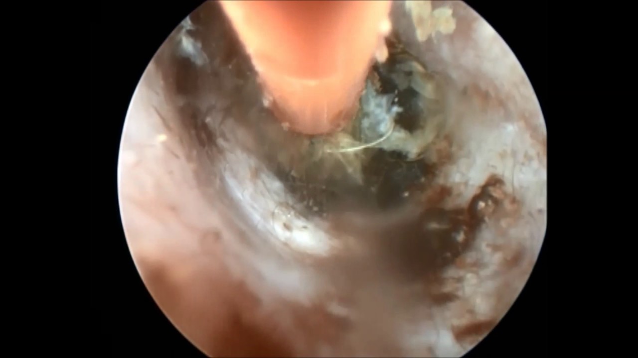 camera iphone 8 plus apk Canine Wax Plug Removal using the Auri-Kleen