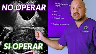 ¿Van a operarte un ovario por quiste o tumor? Primero mira esta clase magistral #SaberEsPoder