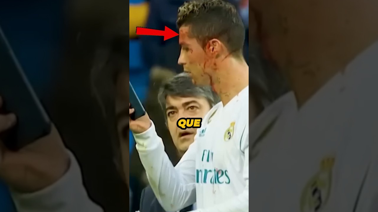 Les Médecins N’en Reviennent Pas : Ronaldo de Retour Dès le Lendemain ! 😱🐐#shorts #ronaldo