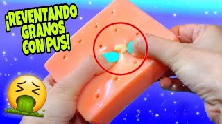 7 PELOTAS ANTIESTRÉS para CORTAR!💥 REVIENTO GRANOS con PUS! 🤮