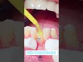 ImanAldresy 🠝🥠ImanAldresy рџ ќрџҐ