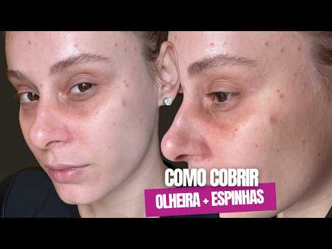 HOW TO PERFECTLY COVER DARK CIRCLES AND ACNE