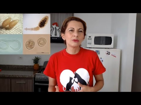 Video: 4 formas de tratar los gusanos de tu gato