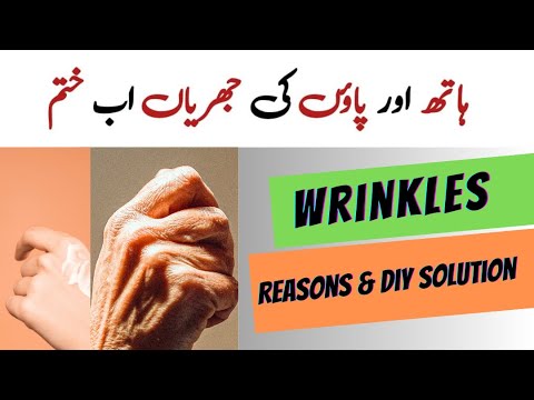 Best Home Remedy for Dry Wrinkle hands and feet | Remedy for Wrinkles ...