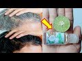 White Hair To Black Hair Naturally in Just 7 Night Permanently at home