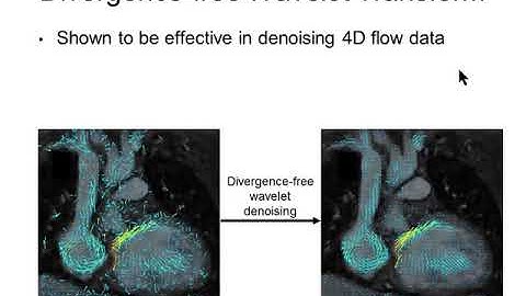 Compressed Sensing MRI with Divergence-free Wavelet Transform