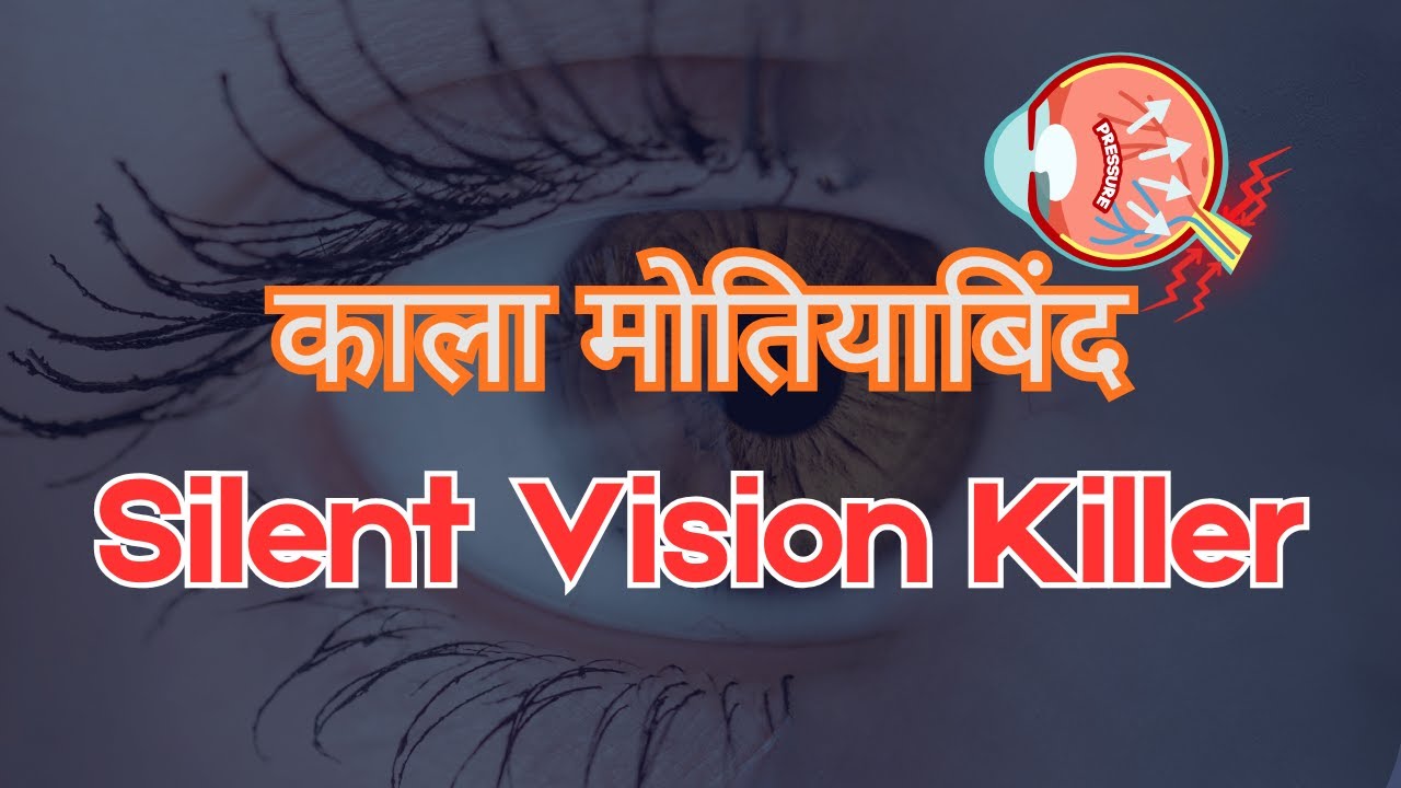 Kala Motiya bindu Full Guide: Types, Symptoms, Causes and Treatment I Glaucoma in Hindi