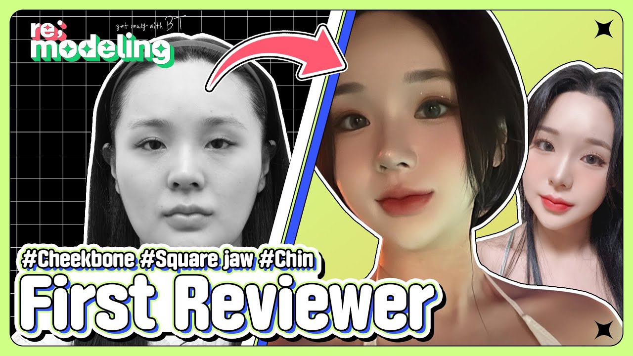 Facial Contouring Surgery Korea Before and After, BT Plastic Surgery