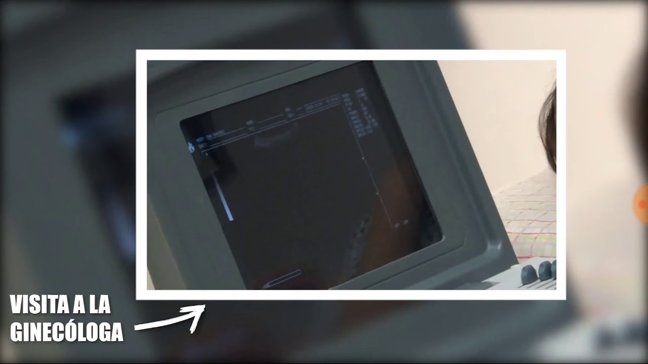 KIMBERLY Y JUAN , CONFIRMAN EL EMBARAZO