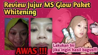 review jujur ms glow paket whitening