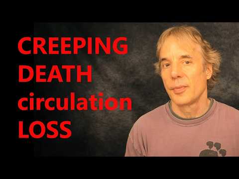 Blood Circulation Loss | Prevent or Suffer