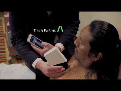 Clarius Mobile Health
