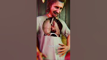 A Man Who Died from Laughing Too Hard