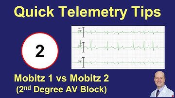 Telemetry Tips - 2nd Degree AV Block (Mobitz 1, Mobitz 2, and 2:1)