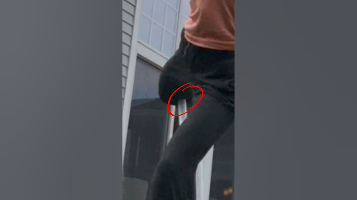My worst hobbyhorsing accident 🤧#hobbyhorse #youtubeshorts