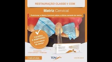 Cervical matrix for Class V