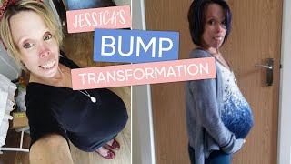 Jessica's Myotonic Dystrophy Bump Transformation | Pregnancy Timelapse