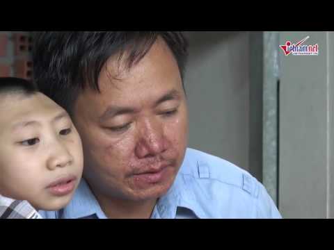 Video Anh Hữu Nghị nói về phản ứng của vợ cũ khi thấy anh... - youtube