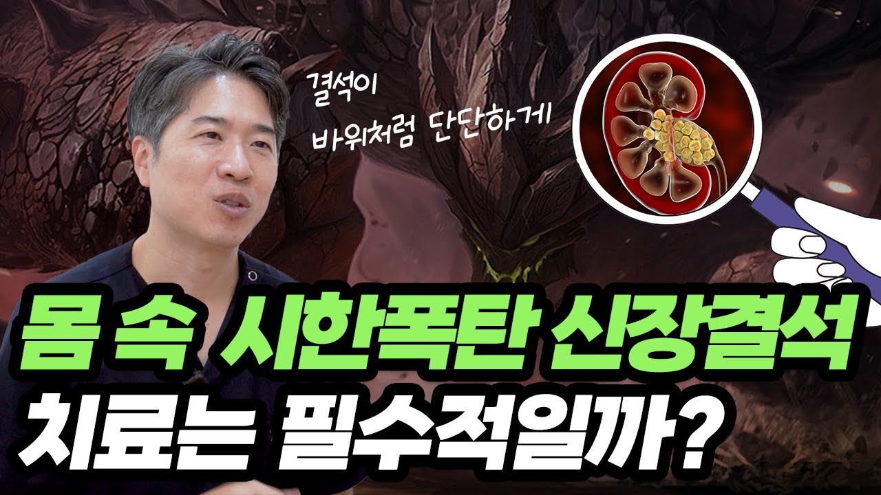 [요로결석] 신장결석과 요관결석은 같을까? 치료는 언제?