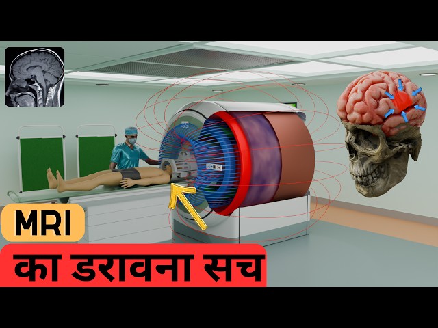 How Does An MRI Machine Work Step By Step ? class=