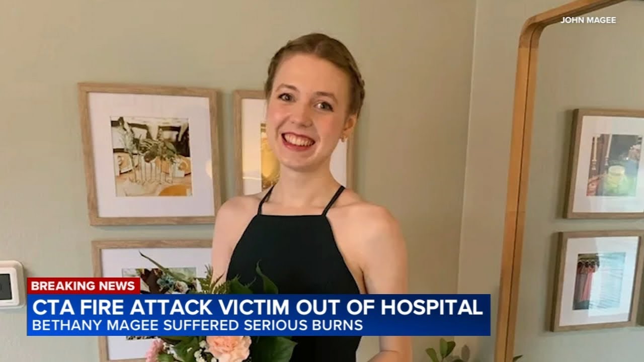 Woman set on fire on CTA Blue Line train in November is released from hospital