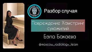 ПОВРЕЖДЕНИЯ ХАМСТРИНГ-СУХОЖИЛИЙ / МРТ / БЭЛА БАКАЕВА / MOSCOW RADIOLOGY TEAM