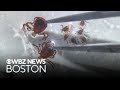 New Hampshire man battling deadly Powassan virus in Boston hospital
