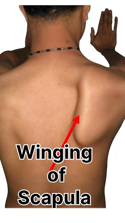 Clinical Scenarios MCQ: Winging of Scapula #anatomy