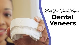 What You Should Know About Dental Veneers | Dr. Brigitte White #dentalveneers #smiletipsforlife by Dr. Brigitte White 280 views 4 years ago 56 seconds