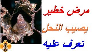 مرض خطير يصيب النحل (تكيس الحضنة)