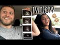 ARE WE HAVING TWINS?? OUR FIRST ULTRASOUND!