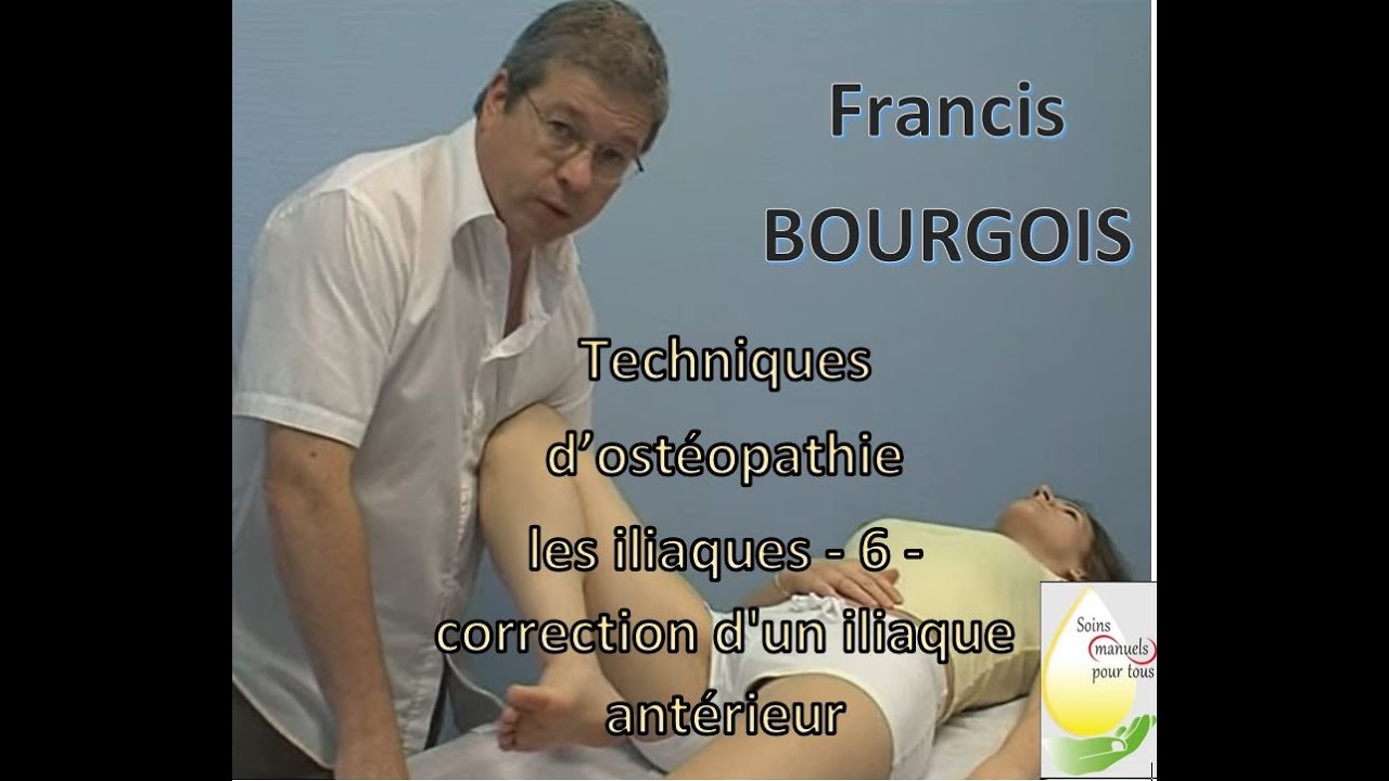 OSTÉOPATHIE - les iliaques - 6 - correction d'un iliaque antérieur