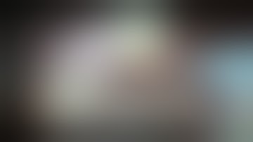 Robotic Prostatectomy (RALP)_10 min