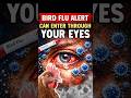 Bird Flu ALERT : It Can Enter Through Your EYES!
