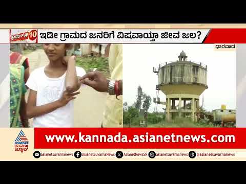Dharwad Tadakoda Water: ಕಲುಷಿತ ನೀರು ಸೇವಿಸಿ ಗ್ರಾಮಸ್ಥರಿಗೆ ಚರ್ಮರೋಗ: ಧಾರವಾಡದ ತಡಕೋಡ ಗ್ರಾಮಸ್ಥರ ಆಕ್ರೋಶ!