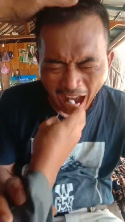 CABUT GIGI TERCEPAT DIDUNIA HANYA ADA DI BANTEN KIDUL