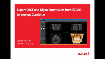 Ez3D-i : Export and Upload to Implant Concierge