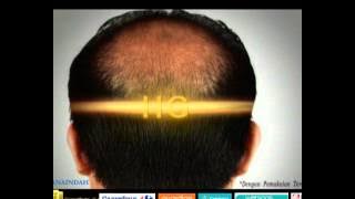 Download lagu HG Shampoo My Choice of Confidence