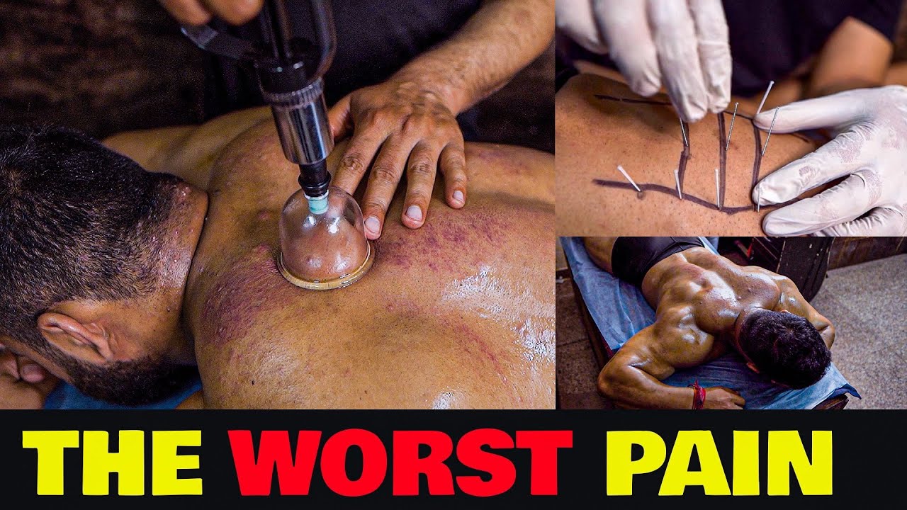 Needling & Graston Therapy For Faster Recovery & Muscle Flexibility||Role Of Therapy In Bodybuilding