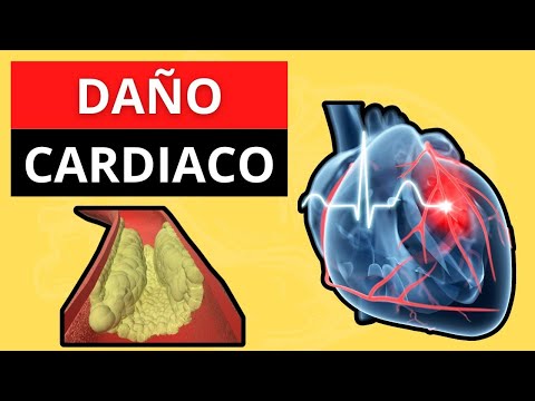 10 hábitos que podrían estar dañando tu corazón