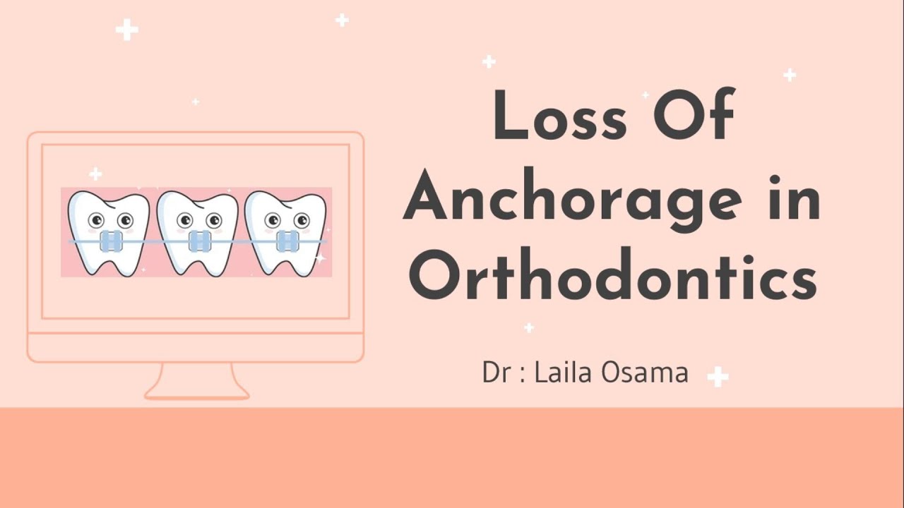 Does anchorage loss differ with 0.018-inch and 0.022-inch slot bracketsystems?