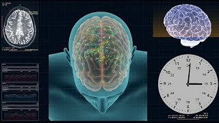 Dopamine Clock Control of Metabolism - Circadian Neuroendocrine Resetting Therapy (CNRT) Overview