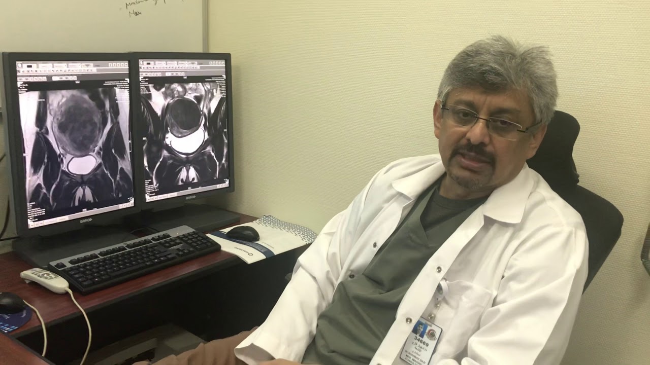Uterine Fibroids Treatment without surgery in Pakistan by Embolization invasive ductal carcinoma