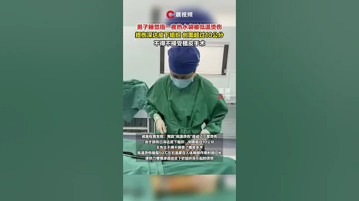 男子睡觉摀一夜热水袋被低温烫伤，伤害深达皮下组织，只好接受植皮手术 #潇湘晨报 #中国社会新闻 #大陆日常 - 天天要闻