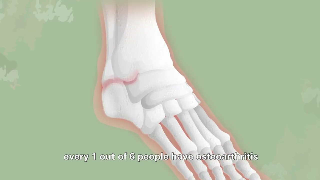 Moveon – Natural Joint Support Drink | Type II Collagen, Turmeric & Vitamin D3