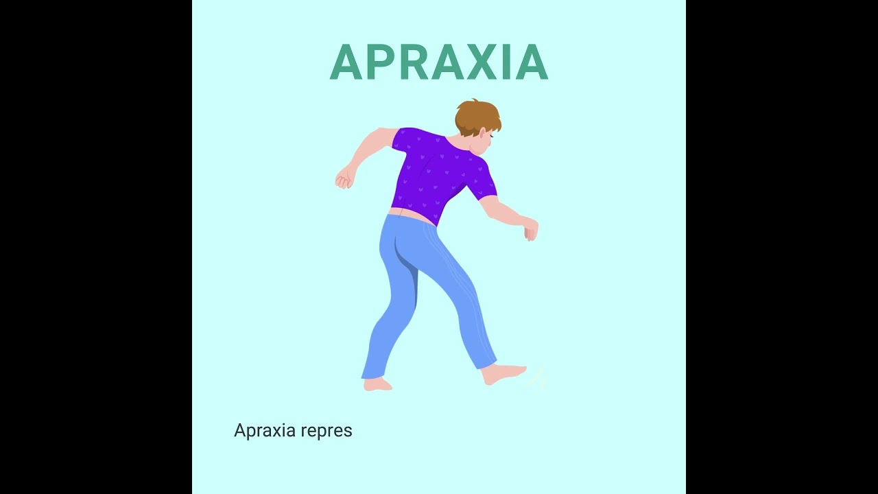 Understanding the "4 A's" of Alzheimer's disease is key to empathy and awareness