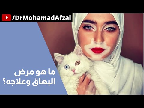  39 ما هو مرض البهاق وطرق علاجه